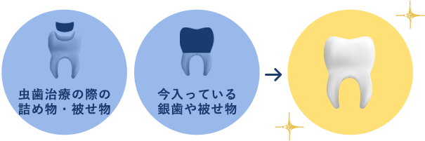 虫歯治療の際の詰め物・被せ物、今入っている銀歯や被せ物